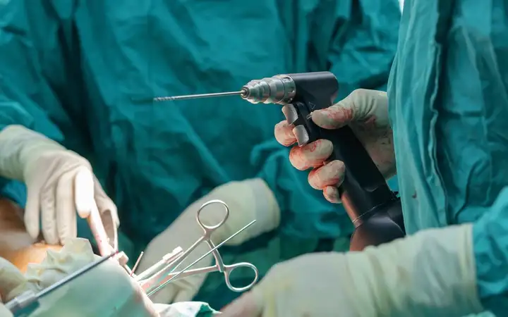 Surgical drill in use during an operation