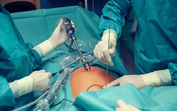 Team of surgeons using a medical endoscope on a patient in a hospital operating theater