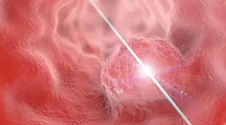 Laser light delivery for photodynamic and thermal treatment applications