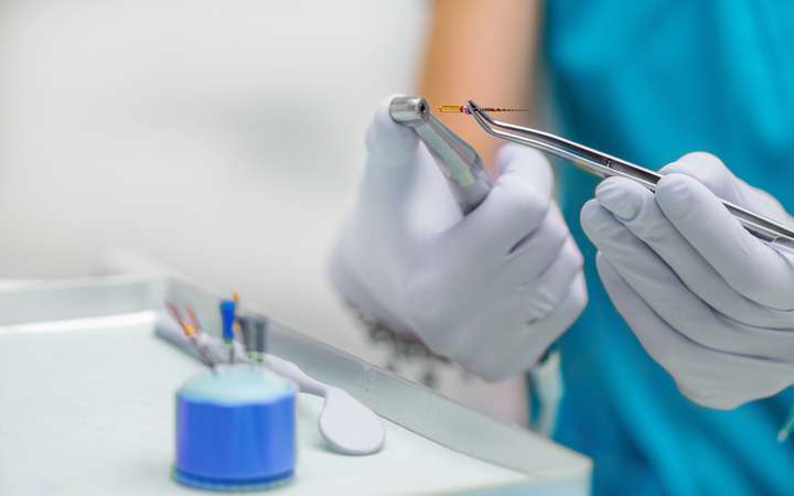 EP-Endodontic Root Canal Treatment 